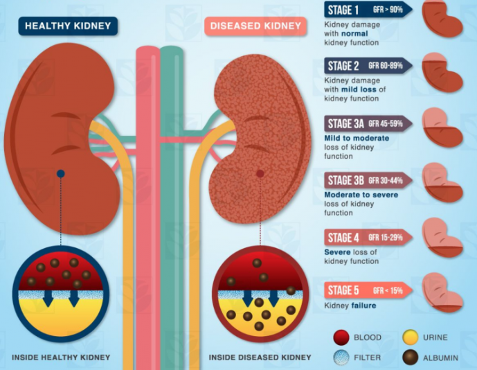 What is Chronic Kidney Disease?