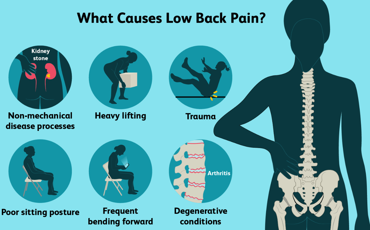 Understanding and Managing Low Back Pain: A Comprehensive Guide